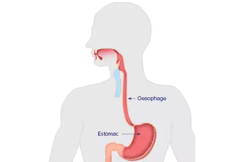 Estomac-Oesophage